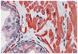 VPS37C, Goat, Polyclonal Antibody, Abnova 100 &mu;g | Buy Online | Abnova Corporation | Fisher Scientific