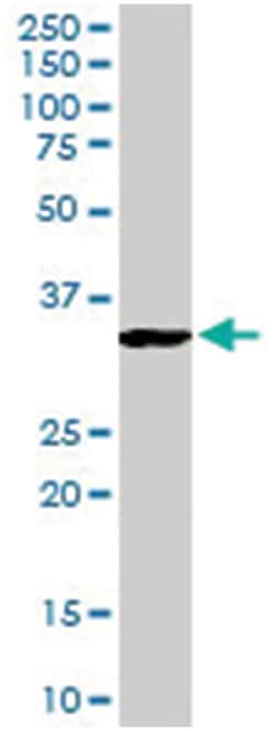 KLRK1, Goat, Polyclonal Antibody, Abnova 100 &mu;g | Buy Online | Abnova Corporation | Fisher Scientific