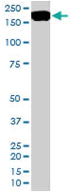 CFH, Goat, Polyclonal Antibody, Abnova 100&mu;g; Unlabeled:Antibodies,