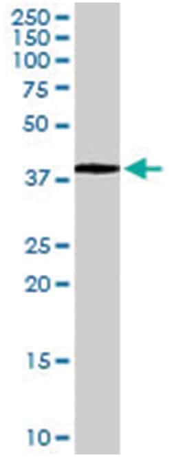 POU5F1, Goat, Polyclonal Antibody, Abnova 100 &mu;g | Buy Online | Abnova Corporation | Fisher Scientific