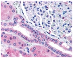 RHPN2, Goat, Polyclonal Antibody, Abnova 100 &mu;g | Buy Online | Abnova | Fisher Scientific