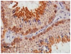 DAZL, Goat, Polyclonal Antibody, Abnova 100 &mu;g | Buy Online | Abnova Corporation | Fisher Scientific