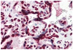 HMGA1 Goat anti-Human, Polyclonal Antibody, Abnova 100 &mu;g | Buy Online | Abnova Corporation | Fisher Scientific