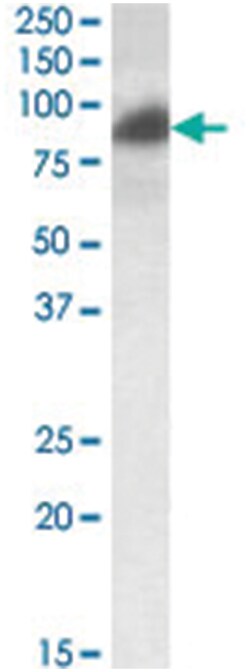 RAB11FIP1, Goat, Polyclonal Antibody, Abnova 100 &mu;g | Buy Online | Abnova Corporation | Fisher Scientific