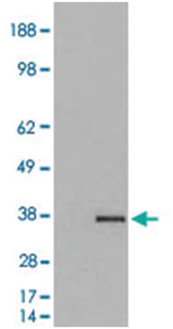 GDF15, Goat, Polyclonal Antibody, Abnova 100 &mu;g | Buy Online | Abnova Corporation | Fisher Scientific