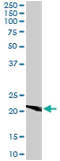 TGIF2, Goat, Polyclonal Antibody, Abnova 100&mu;g; Unlabeled:Antibodies,