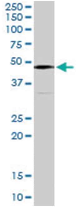 PLAU, Goat, Polyclonal Antibody, Abnova 100 &mu;g | Buy Online | Abnova Corporation | Fisher Scientific