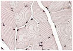 LDB3, Goat, Polyclonal Antibody, Abnova 100 &mu;g | Buy Online | Abnova Corporation | Fisher Scientific