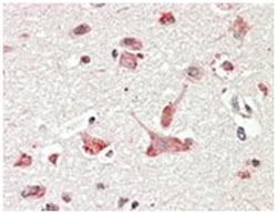 GOLGA6A/GOLGA6B, Goat, Polyclonal Antibody, Abnova 100&mu;g; Unlabeled:Antibodies,