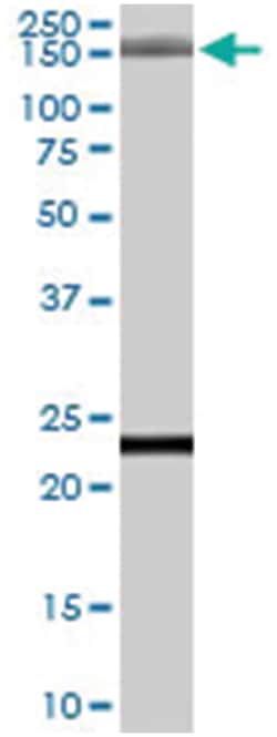 GOLGA3, Goat, Polyclonal Antibody, Abnova 100 &mu;g | Buy Online | Abnova Corporation | Fisher Scientific