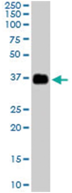 CLU Goat anti-Human, Polyclonal Antibody, Abnova 100&mu;g; Unlabeled:Antibodies,