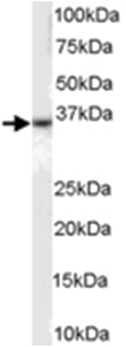 DARC, Goat, Polyclonal Antibody, Abnova 100 &mu;g | Buy Online | Abnova | Fisher Scientific