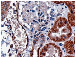 DARC, Goat, Polyclonal Antibody, Abnova 100 &mu;g | Buy Online | Abnova | Fisher Scientific