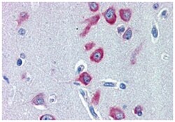 PCK1 Goat anti-Human, Polyclonal Antibody, Abnova 100 &mu;g | Buy Online | Abnova Corporation | Fisher Scientific