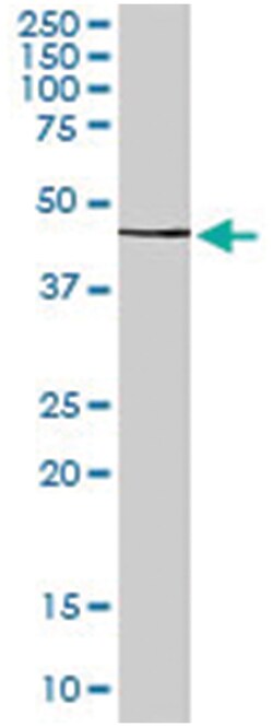 CNR2, Goat, Polyclonal Antibody, Abnova 100 &mu;g | Buy Online | Abnova Corporation | Fisher Scientific