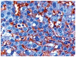 ENPP1, Goat, Polyclonal Antibody, Abnova 100 &mu;g | Buy Online | Abnova Corporation | Fisher Scientific