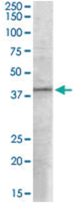 EIF3M, Goat, Polyclonal Antibody, Abnova 100 &mu;g | Buy Online | Abnova Corporation | Fisher Scientific