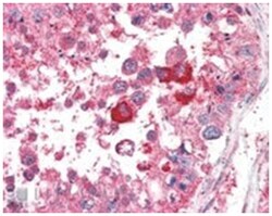 EIF3M, Goat, Polyclonal Antibody, Abnova 100 &mu;g | Buy Online | Abnova Corporation | Fisher Scientific