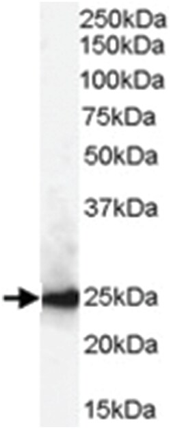 CBX1, Goat, Polyclonal Antibody, Abnova 100 &mu;g | Buy Online | Abnova Corporation | Fisher Scientific