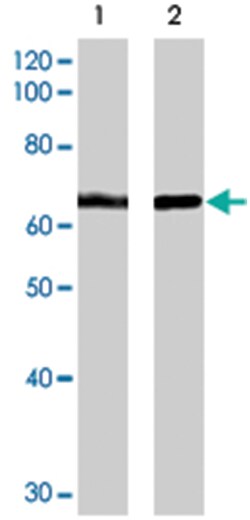 HEXIM1, Goat, Polyclonal Antibody, Abnova 100 &mu;g | Buy Online | Abnova Corporation | Fisher Scientific