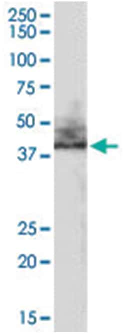 SLC9A3R2 Goat anti-Human, Polyclonal Antibody, Abnova 100 &mu;g | Buy Online | Abnova Corporation | Fisher Scientific