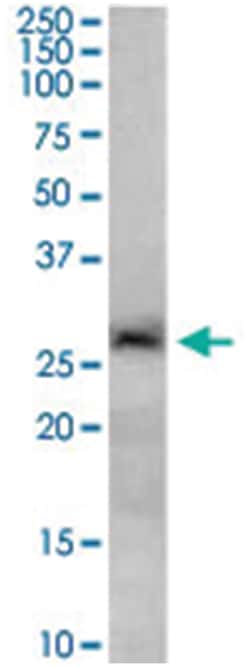SIRT3 Goat anti-Human, Polyclonal Antibody, Abnova 100&mu;g; Unlabeled:Antibodies,