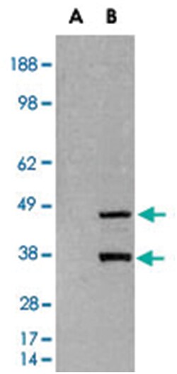 SIRT3 Goat anti-Human, Polyclonal Antibody, Abnova 100&mu;g; Unlabeled:Antibodies,