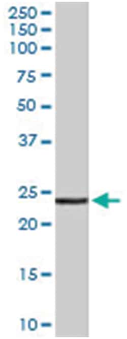 TIRAP Goat anti-Human, Polyclonal Antibody, Abnova 100 &mu;g | Buy Online | Abnova Corporation | Fisher Scientific