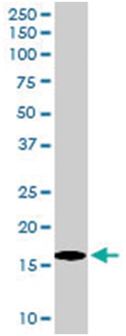 SH2D1A Goat anti-Human, Polyclonal Antibody, Abnova 100&mu;g; Unlabeled:Antibodies,