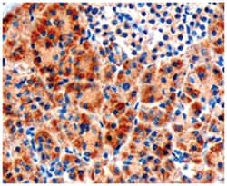 FZD8, Goat, Polyclonal Antibody, Abnova 100 &mu;g | Buy Online | Abnova Corporation | Fisher Scientific