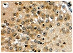 NOTCH3, Goat, Polyclonal Antibody, Abnova 100 &mu;g | Buy Online | Abnova Corporation | Fisher Scientific