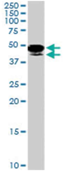 PAX8 Goat anti-Human, Polyclonal Antibody, Abnova 100 &mu;g | Buy Online | Abnova Corporation | Fisher Scientific