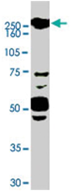 ROBO1, Goat, Polyclonal Antibody, Abnova 100 &mu;g | Buy Online | Abnova Corporation | Fisher Scientific