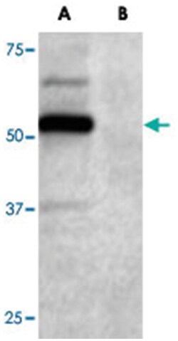 DCDC2, Goat, Polyclonal Antibody, Abnova 100 &mu;g | Buy Online | Abnova Corporation | Fisher Scientific