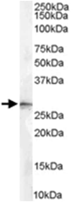 SFN, Goat, Polyclonal Antibody, Abnova 100&mu;g; Unlabeled:Antibodies,