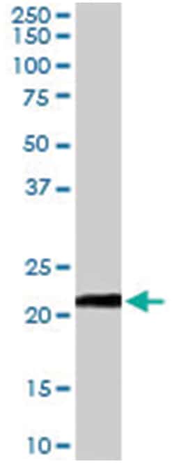 VPS25, Goat, Polyclonal Antibody, Abnova 100 &mu;g | Buy Online | Abnova Corporation | Fisher Scientific
