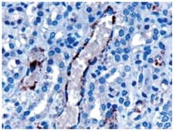 VPS25, Goat, Polyclonal Antibody, Abnova 100 &mu;g | Buy Online | Abnova Corporation | Fisher Scientific