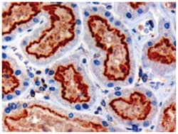 IFT88, Goat, Polyclonal Antibody, Abnova 100&mu;g; Unlabeled:Antibodies,