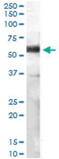 CD14, Goat, Polyclonal Antibody, Abnova 100 &mu;g | Buy Online | Abnova Corporation | Fisher Scientific