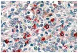 CD14, Goat, Polyclonal Antibody, Abnova 100 &mu;g | Buy Online | Abnova Corporation | Fisher Scientific