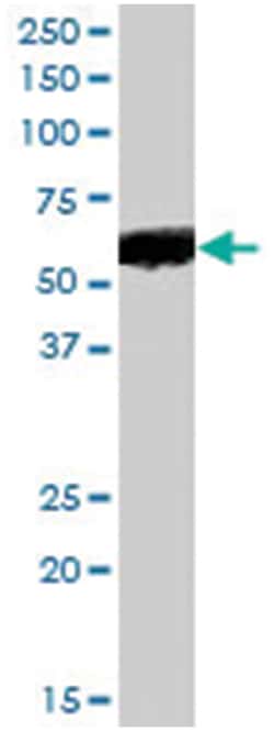 PTGER4, Goat, Polyclonal Antibody, Abnova 100&mu;g; Unlabeled:Anticuerpos