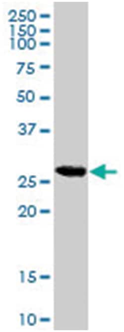 CDKN1B Goat anti-Human, Polyclonal Antibody, Abnova 100 &mu;g | Buy Online | Abnova Corporation | Fisher Scientific