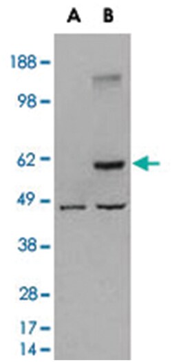 TRAF2, Goat, Polyclonal Antibody, Abnova 100 &mu;g | Buy Online | Abnova Corporation | Fisher Scientific