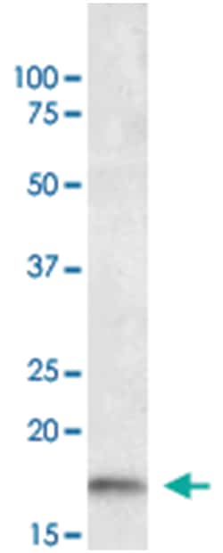 AIF1 Goat anti-Human, Polyclonal Antibody, Abnova 100 &mu;g | Buy Online | Abnova Corporation | Fisher Scientific