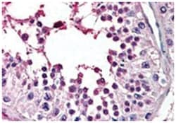 PIAS2 Goat anti-Human, Polyclonal Antibody, Abnova 100 &mu;g | Buy Online | Abnova Corporation | Fisher Scientific