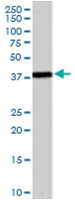 GALR3, Goat, Polyclonal Antibody, Abnova 100 &mu;g | Buy Online | Abnova Corporation | Fisher Scientific