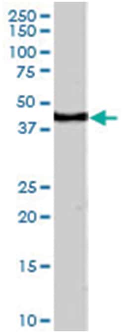 CDX2, Goat, Polyclonal Antibody, Abnova 100 &mu;g | Buy Online | Abnova Corporation | Fisher Scientific