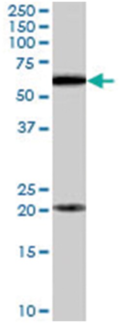 BMPR1A, Goat, Polyclonal Antibody, Abnova 100 &mu;g | Buy Online | Abnova Corporation | Fisher Scientific