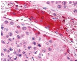 HGS, Goat, Polyclonal Antibody, Abnova 100 &mu;g | Buy Online | Abnova Corporation | Fisher Scientific