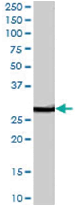VTI1B, Goat, Polyclonal Antibody, Abnova 100 &mu;g | Buy Online | Abnova Corporation | Fisher Scientific